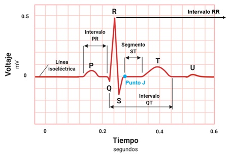 Comprendiendo el Electrocardiograma: Claves para Interpretar sus Componentes